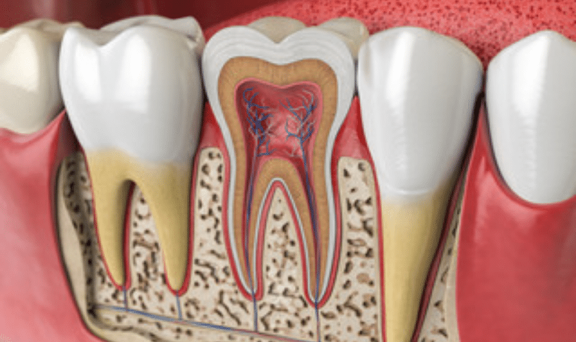 Root canal treatment