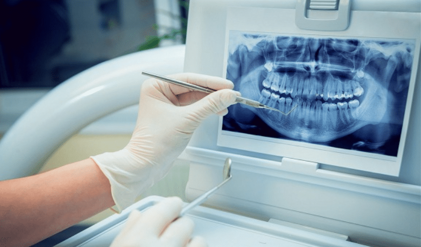 Digital x rays in Tinley Park