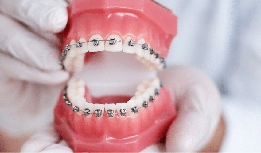 Orthodontic treatment for children