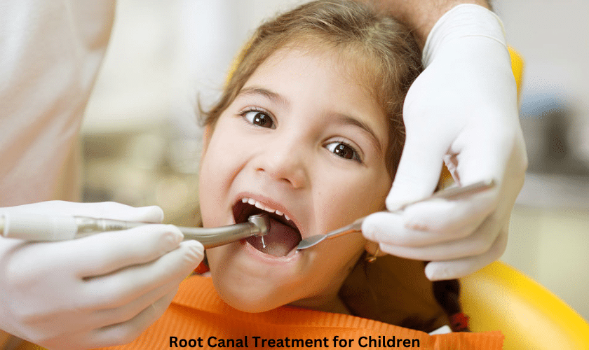 Root Canal Treatment for Children