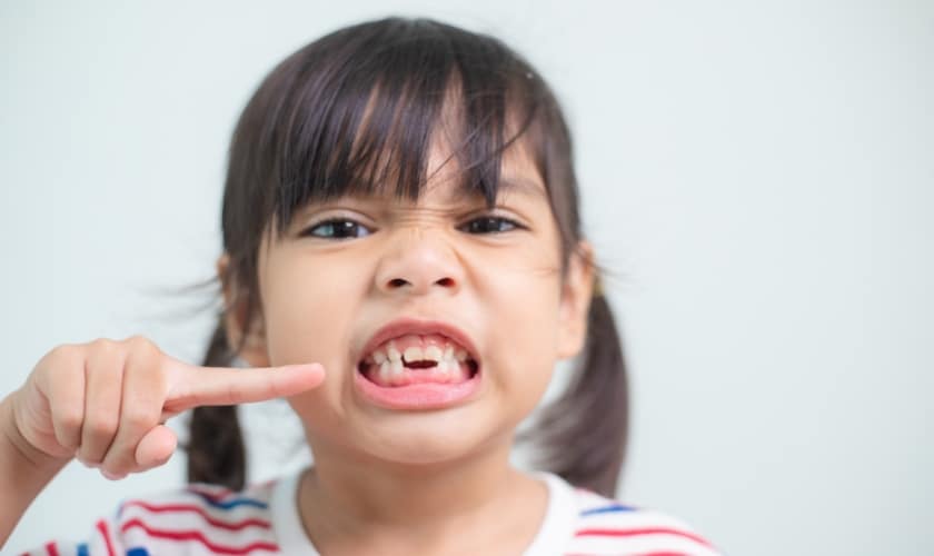 Solutions for a Half-Broken Teeth (Including Half-Broken Molars)