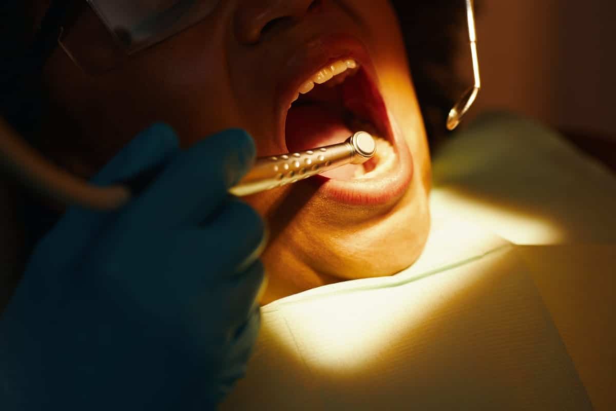 Root Canal Treatment in Tinley Park